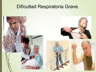 Dificultad Respiratoria Grave
 