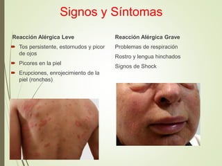 Signos y Síntomas
Reacción Alérgica Leve
 Tos persistente, estornudos y picor
de ojos
 Picores en la piel
 Erupciones, enrojecimiento de la
piel (ronchas)
Reacción Alérgica Grave
Problemas de respiración
Rostro y lengua hinchados
Signos de Shock
 
