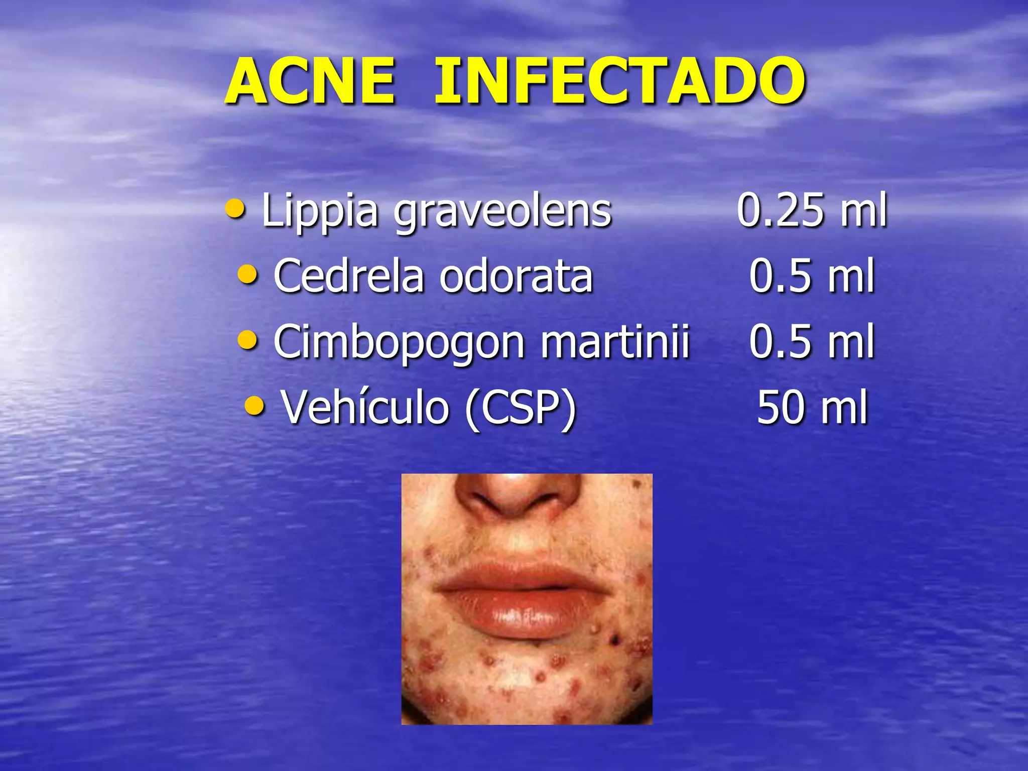 ACNE INFECTADO
• Lippia graveolens
0.25 ml
• Cedrela odorata
0.5 ml
• Cimbopogon martinii 0.5 ml
• Vehículo (CSP)
50 ml

 