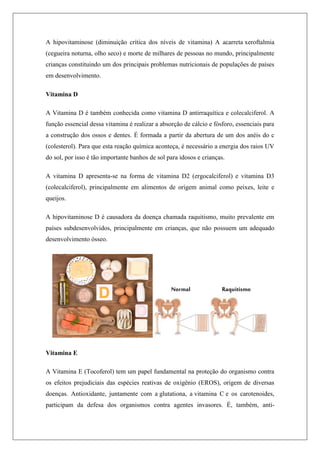 A hipovitaminose (diminuição crítica dos níveis de vitamina) A acarreta xeroftalmia
(cegueira noturna, olho seco) e morte de milhares de pessoas no mundo, principalmente
crianças constituindo um dos principais problemas nutricionais de populações de países
em desenvolvimento.
Vitamina D
A Vitamina D é também conhecida como vitamina D antirraquítica e colecalciferol. A
função essencial dessa vitamina é realizar a absorção de cálcio e fósforo, essenciais para
a construção dos ossos e dentes. É formada a partir da abertura de um dos anéis do c
(colesterol). Para que esta reação química aconteça, é necessário a energia dos raios UV
do sol, por isso é tão importante banhos de sol para idosos e crianças.
A vitamina D apresenta-se na forma de vitamina D2 (ergocalciferol) e vitamina D3
(colecalciferol), principalmente em alimentos de origem animal como peixes, leite e
queijos.
A hipovitaminose D é causadora da doença chamada raquitismo, muito prevalente em
países subdesenvolvidos, principalmente em crianças, que não possuem um adequado
desenvolvimento ósseo.
Vitamina E
A Vitamina E (Tocoferol) tem um papel fundamental na proteção do organismo contra
os efeitos prejudiciais das espécies reativas de oxigênio (EROS), origem de diversas
doenças. Antioxidante, juntamente com a glutationa, a vitamina C e os carotenoides,
participam da defesa dos organismos contra agentes invasores. É, também, anti-
 