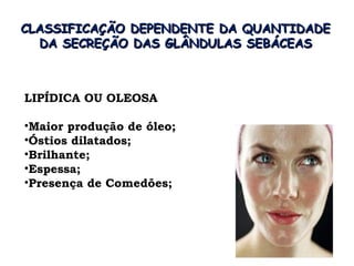 CLASSIFICAÇÃO DEPENDENTE DA QUANTIDADE
  DA SECREÇÃO DAS GLÂNDULAS SEBÁCEAS



LIPÍDICA OU OLEOSA

•Maior produção de óleo;
•Óstios dilatados;
•Brilhante;
•Espessa;
•Presença de Comedões;
 