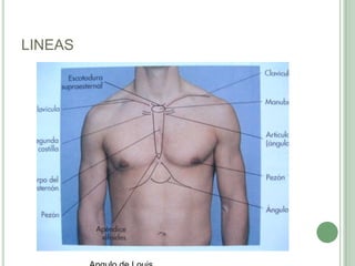 LINEAS Angulo de Louis