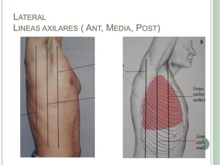 LateralLineas axilares ( Ant, Media, Post)
