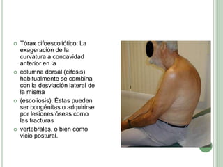 Tórax cifoescoliótico: La exageración de la curvatura a concavidad anterior en lacolumna dorsal (cifosis) habitualmente se combina con la desviación lateral de la misma(escoliosis). Éstas pueden ser congénitas o adquirirse por lesiones óseas como las fracturasvertebrales, o bien como vicio postural.