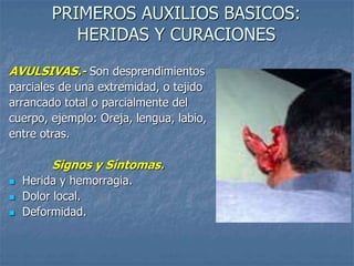 PRIMEROS AUXILIOS BASICOS:
HERIDAS Y CURACIONES
AVULSIVAS.- Son desprendimientos
parciales de una extremidad, o tejido
arrancado total o parcialmente del
cuerpo, ejemplo: Oreja, lengua, labio,
entre otras.
Signos y Síntomas.
 Herida y hemorragia.
 Dolor local.
 Deformidad.
 
