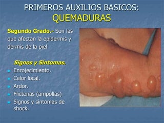 PRIMEROS AUXILIOS BASICOS:
QUEMADURAS
Segundo Grado.- Son las
que afectan la epidermis y
dermis de la piel
Signos y Síntomas.
 Enrojecimiento.
 Calor local.
 Ardor.
 Flictenas (ampollas)
 Signos y síntomas de
shock.
 