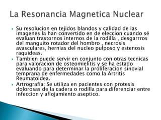 iii) Cortocircuito intestinal