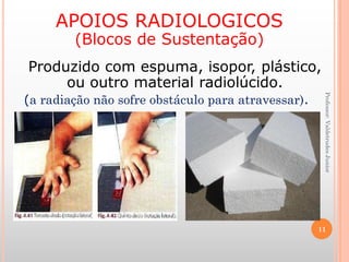 Professor:ValdetrudesJunior
APOIOS RADIOLOGICOS
(Blocos de Sustentação)
Produzido com espuma, isopor, plástico,
ou outro material radiolúcido.
(a radiação não sofre obstáculo para atravessar).
11
 