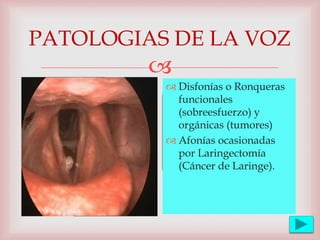 
PATOLOGIAS DE LA VOZ
 Disfonías o Ronqueras
funcionales
(sobreesfuerzo) y
orgánicas (tumores)
 Afonías ocasionadas
por Laringectomía
(Cáncer de Laringe).
 