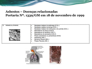Asbestos – Doenças relacionadas
Portaria Nº. 1339/GM em 18 de novembro de 1999
 