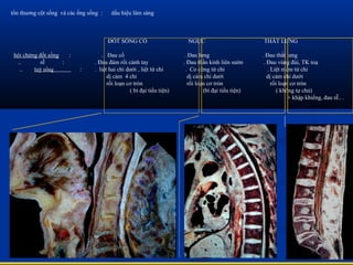 tổn thuơng cột sống và các ống sống : dấu hiệu lâm sàng
ĐỐT SỐNG CỔ NGỰC THẮT LƯNG
hội chứng đốt sống : . Đau cổ . Đau lưng . Đau thắt lưng
.. rễ : . Đau đám rối cánh tay . Đau thần kinh liên sườn . Đau vùng đùi, TK toạ
.. tuỷ sống : . liệt hai chi dưới , liệt tứ chi . Co cứng tứ chi . Liệt mềm tứ chi
dị cảm 4 chi dị cảm chi dưới dị cảm chi dưới
rối loạn cơ tròn rối loạn cơ tròn rối loạn cơ tròn
( bí đại tiểu tiện) (bí đại tiểu tiện) ( không tự chủ)
+ khập khiểng, đau rễ.. .
 