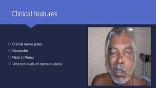 Clinical features
 Cranial nerve palsy
 Headache
 Neck stiffness
 Altered levels of consciousness
 