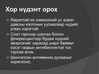 Хор нүдэнт орох
 Яаралтай их хэмжээний ус эсвэл
давсны изотоник уусмалаар нүдийг
угаах хэрэгтэй.
 Слит гэрлээр шалгах болон
флюресцентээр будаж нүдний
эвэрлэгийг харахад шарх байвал
хэсэг газрын антибиотиктой тос
түрхэж өгнө.
 Шингэлсэн антивеном дусаахыг
хориглоно.
 