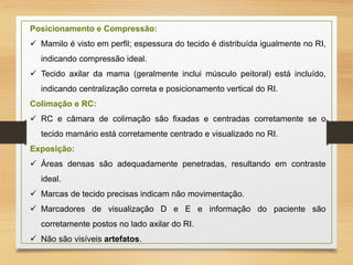 Posicionamento e Compressão:
 Mamilo é visto em perfil; espessura do tecido é distribuída igualmente no RI,
indicando compressão ideal.
 Tecido axilar da mama (geralmente inclui músculo peitoral) está incluído,
indicando centralização correta e posicionamento vertical do RI.
Colimação e RC:
 RC e câmara de colimação são fixadas e centradas corretamente se o
tecido mamário está corretamente centrado e visualizado no RI.
Exposição:
 Áreas densas são adequadamente penetradas, resultando em contraste
ideal.
 Marcas de tecido precisas indicam não movimentação.
 Marcadores de visualização D e E e informação do paciente são
corretamente postos no lado axilar do RI.
 Não são visíveis artefatos.
 