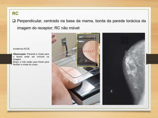 RC
 Perpendicular, centrado na base da mama, borda da parede torácica da
imagem do receptor; RC não móvel
Incidência XCCE.
Observação: Paciente é virado para
o tecido axilar ser incluído na
imagem.
Braço e mão estão para frente para
facilitar a virada do corpo.
 
