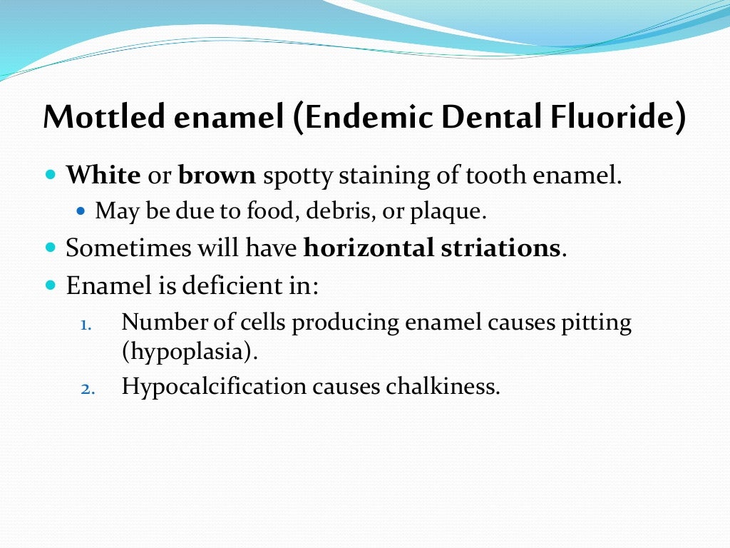 fluoride in dentist
