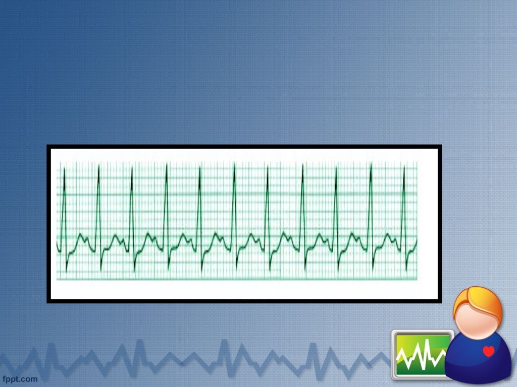 defibrillation and cardioversion