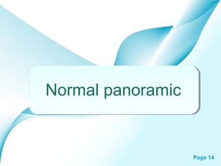 Normal panoramic

Powerpoint Templates

Page 14

 