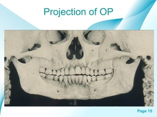 Projection of OP

Powerpoint Templates

Page 15

 