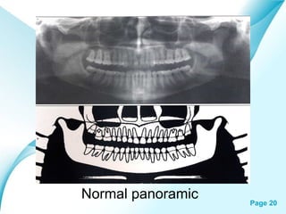 Normal panoramic
Powerpoint Templates

Page 20

 