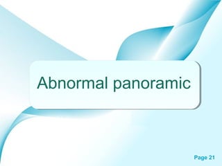 Abnormal panoramic

Powerpoint Templates

Page 21

 