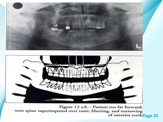 Powerpoint Templates

Page 22

 