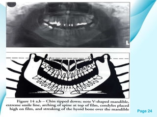 Powerpoint Templates

Page 24

 