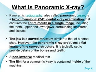 What is Panoramic X-ray?
• Panoramic radiography, also called panoramic x-ray, is
a two-dimensional (2-D) dental x-ray examination that
captures the entire mouth in a single image, including
the teeth, upper and lower jaws, surrounding structures
and tissues.
• The jaw is a curved structure similar to that of a horse
shoe. However, the panoramic x-ray produces a flat
image of the curved structure. It is typically set to
provide details of the bones and teeth.
• A non-invasive medical test .
• The film for a panoramic x-ray is contained inside of the
machine.
Powerpoint Templates

Page 4

 