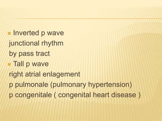  Inverted p wave
junctional rhythm
by pass tract
 Tall p wave
right atrial enlagement
p pulmonale (pulmonary hypertension)
p congenitale ( congenital heart disease )
 
