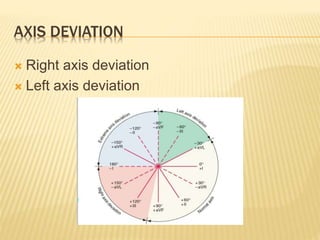 AXIS DEVIATION
 Right axis deviation
 Left axis deviation
 