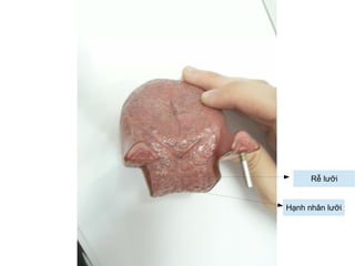 Rễ lưỡi
Hạnh nhân lưỡi
 