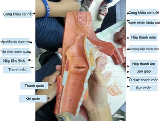 Sụn nhẫn
Cung khẩu cái lưỡi
Hạnh nhân khẩu cái
Nắp thanh môn
Dc móng nắp thanh môn
Nếp thanh âm
Sụn giáp
Ổ dưới thanh môn
Cung khẩu cái hầu
Nếp phễu nắp thanh môn
Tiền đình (thanh quản)
Nếp tiền đình
Thanh thất
Thanh quản
Khí quản
 