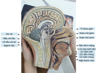 Tk khứu giác
Xoăn mũi giữa
Xoăn mũi dưới
Cơ dọc lưỡi trên
Tiền đình miệng
Cơ cằm lưỡi
Cơ cằm móng
Cơ hàm móng
Nắp thanh môn
Gờ vòi
Nếp vòi-hầu
Lỗ hầu-vòi tai
Ngách hầu
 