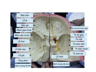 Dải khứu(tk khứu giác)
Tk hàm trên
Tk sinh ba
Tk thị giác
Tk mắt
Tk hàm dưới
Lỗ rách
Mào trán
Rãnh xoang đá dưới
Lỗ tịt
Mào gà
Rãnh giao thoa
Mỏm yên trước
Lỗ tròn
Lỗ bầu dục
Lỗ gai
Ống cảnh
Rãnh xoang đá trên
 