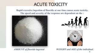 Comprehensive Overview of Fluoride Toxicity and Fluorosis: Causes ...