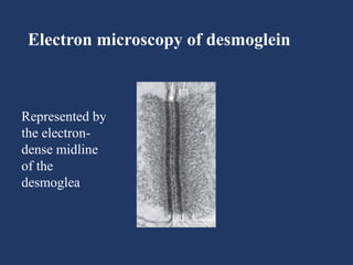 Electron microscopy of desmoglein
Represented by
the electron-
dense midline
of the
desmoglea
 