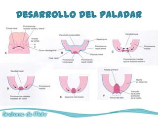 Desarrollo del paladar
 