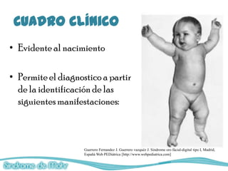 Cuadro clínico
• Evidente al nacimiento

• Permite el diagnostico a partir
  de la identificación de las
  siguientes manifestaciones:



                    Guerrero Fernandez J. Guerrero vazquéz J. Sindrome oro fácial-digital tipo I, Madrid,
                    Españá Web PEDiátrica [http://www.webpediatrica.com]
 