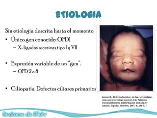 ETIOLOGIA
Sin etiología descrita hasta el momento.
• Único gen conocido: OFD1
   – X-ligadas recesivas tipo I y VII


• Expresión variable de un “gen”.
   – OFD 2 a 8


• Ciliopatía. Defectos ciliares primarios
                                            Kennet L. Defectos faciales y de las extremidades
                                            como características mayores. En: Patrones
                                            reconocibles de la malformación humana. 6ª
                                            edición. España: Elsevier; 2007. P. 286-337.
 