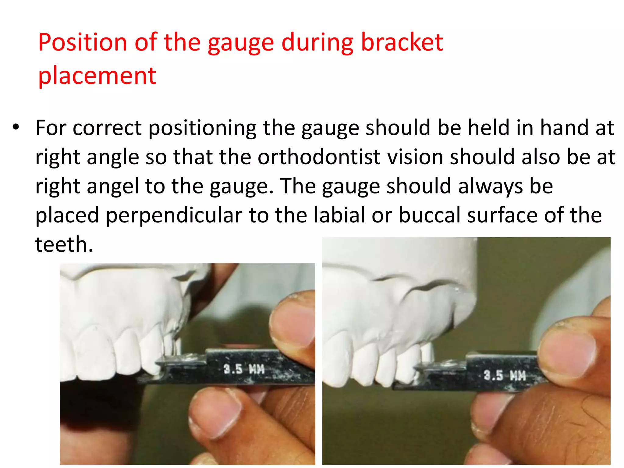 Position of the gauge during bracket
placement
• For correct positioning the gauge should be held in hand at
right angle so that the orthodontist vision should also be at
right angel to the gauge. The gauge should always be
placed perpendicular to the labial or buccal surface of the
teeth.
 