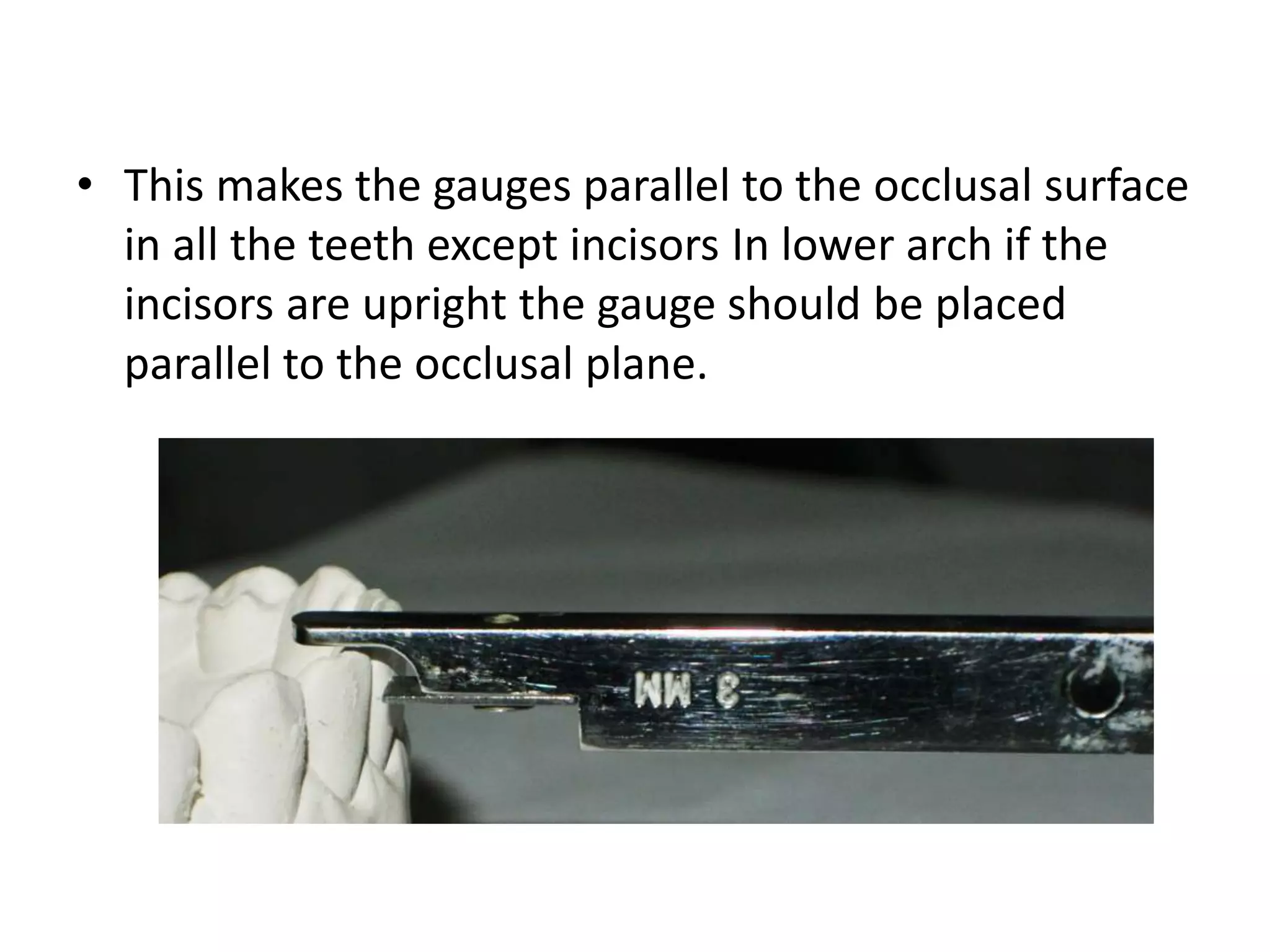 • This makes the gauges parallel to the occlusal surface
in all the teeth except incisors In lower arch if the
incisors are upright the gauge should be placed
parallel to the occlusal plane.
 