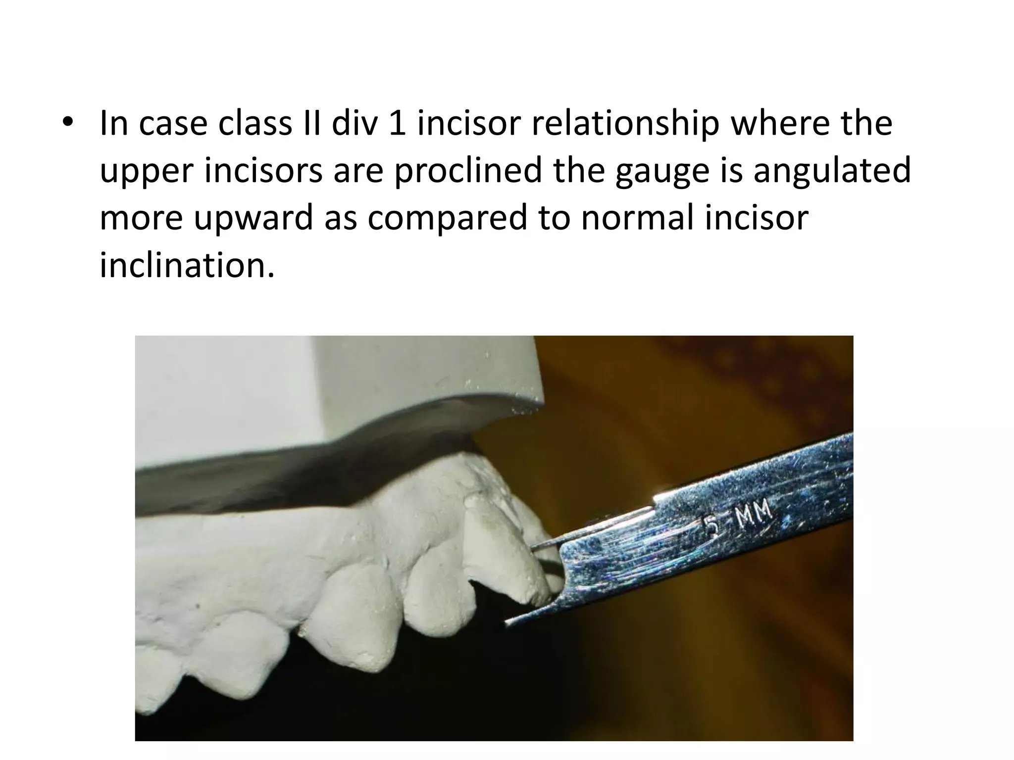 • In case class II div 1 incisor relationship where the
upper incisors are proclined the gauge is angulated
more upward as compared to normal incisor
inclination.
 