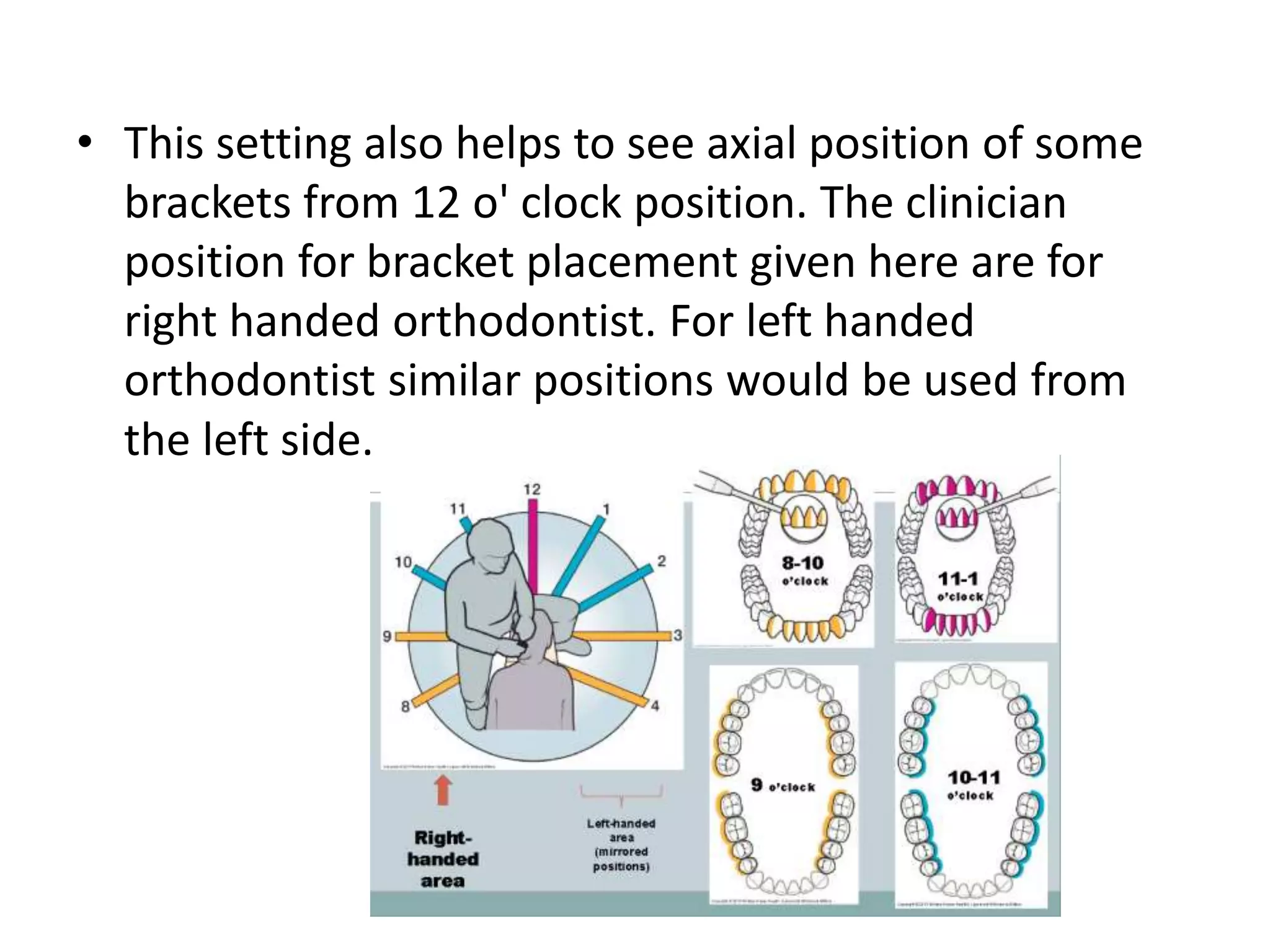 • This setting also helps to see axial position of some
brackets from 12 o' clock position. The clinician
position for bracket placement given here are for
right handed orthodontist. For left handed
orthodontist similar positions would be used from
the left side.
 