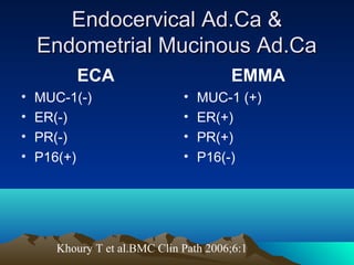 Endocervical Ad.Ca &
Endometrial Mucinous Ad.Ca
ECA
•
•
•
•

MUC-1(-)
ER(-)
PR(-)
P16(+)

EMMA
•
•
•
•

MUC-1 (+)
ER(+)
PR(+)
P16(-)

Khoury T et al.BMC Clin Path 2006;6:1

 