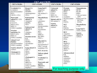 CK7 and CK20

For teaching purpose only
http://www.pathinformatics.com/department/documents/SusanE%20Lecture.pdf

 