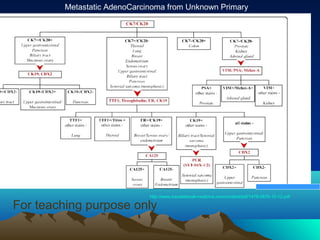 Metastatic AdenoCarcinoma from Unknown Primary

Tumors from Unknown Primary Site

http://www.translational-medicine.com/content/pdf/1479-5876-10-12.pdf

For teaching purpose only

 