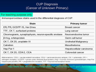 CUP Diagnosis
(Cancer of Unknown Primary)
For teaching purpose only

http://www.ncbi.nlm.nih.gov/pmc/articles/PMC2631214/figure/f1-gcr1_6p0229/

 