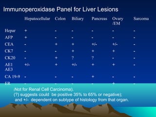 Immunoperoxidase Panel for Liver Lesions
Hepatocellular

Colon

Biliary

Pancreas

Ovary
/EM

Sarcoma

Hepar

+

-

-

-

-

-

AFP

+

-

-

-

-

-

CEA

-

+

+

+/-

+/-

-

CK7

-

-

+

+

+

-

CK20

-

+

?

?

-

-

AE1
AE3

+/-

+

+/-

+

+

-

CA 19-9

-

-

-

+

-

-

ER

+
(Not for Renal Cell Carcinoma).
(?) suggests could be positive 35% to 65% or negative);
and +/- dependent on subtype of histology from that organ.

-

 