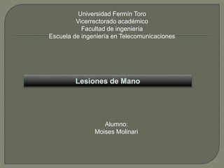 Universidad Fermín Toro
Vicerrectorado académico
Facultad de ingeniería
Escuela de ingeniería en Telecomunicaciones
Alumno:
Moises Molinari
 