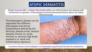 Comprehensive Insights into Atopic Dermatitis: Pathogenesis, Diagnosis ...